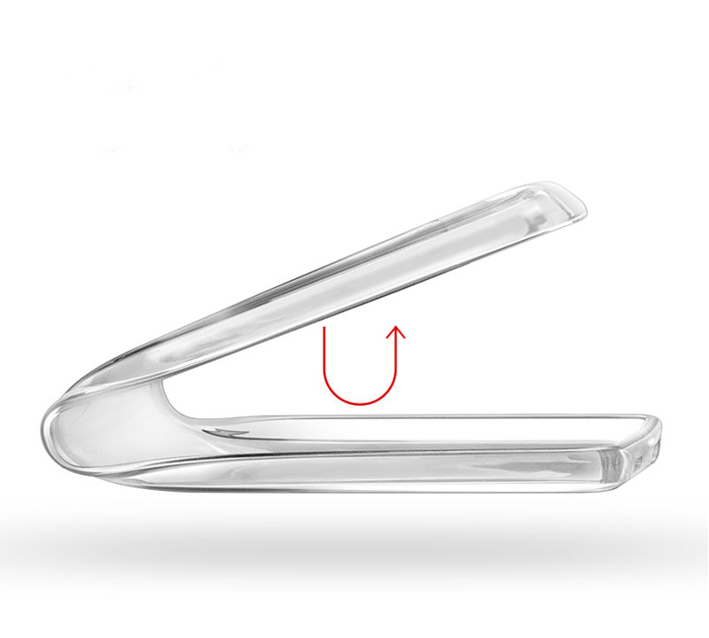 ốp lưng xiaomi mi note silicone ốp lưng xiaomi mi note silicone